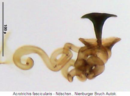 acrotrichis_fascicularis2_sperm.jpg