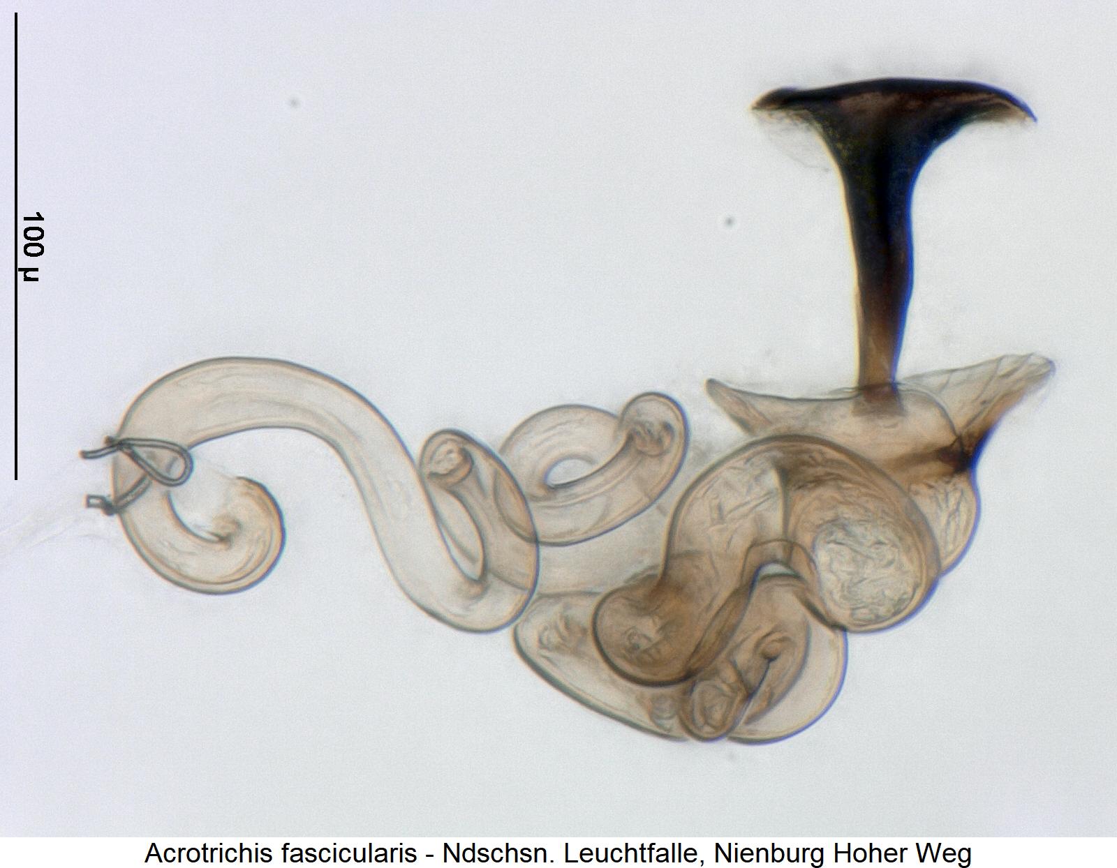 acrotrichis_fascicularis_sperm1.jpg