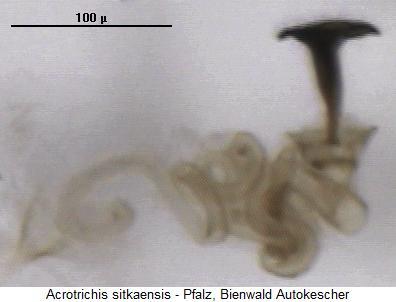 acrotrichis_sitkaensis_sperm2.jpg