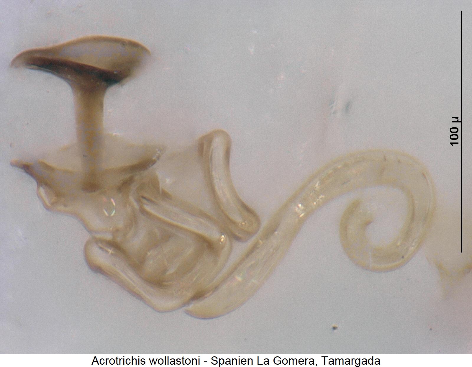 acrotrichis_wollastoni_sperm.jpg