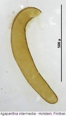 agapanthia_intermedia_sperm.jpg