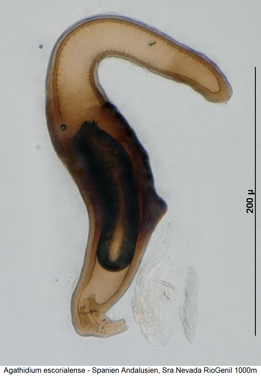 agathidium_escorialense_sperm.jpg