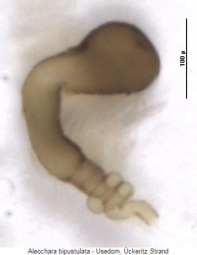aleochara_bipustulata_sperm.jpg