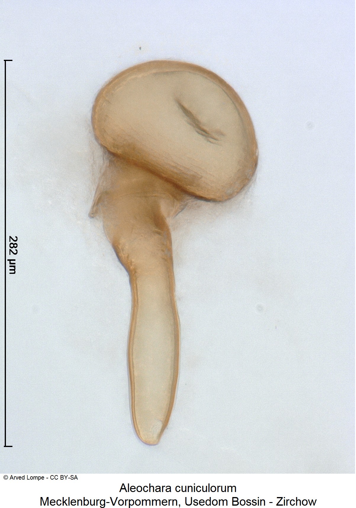 aleochara_cuniculorum_sperm.jpg
