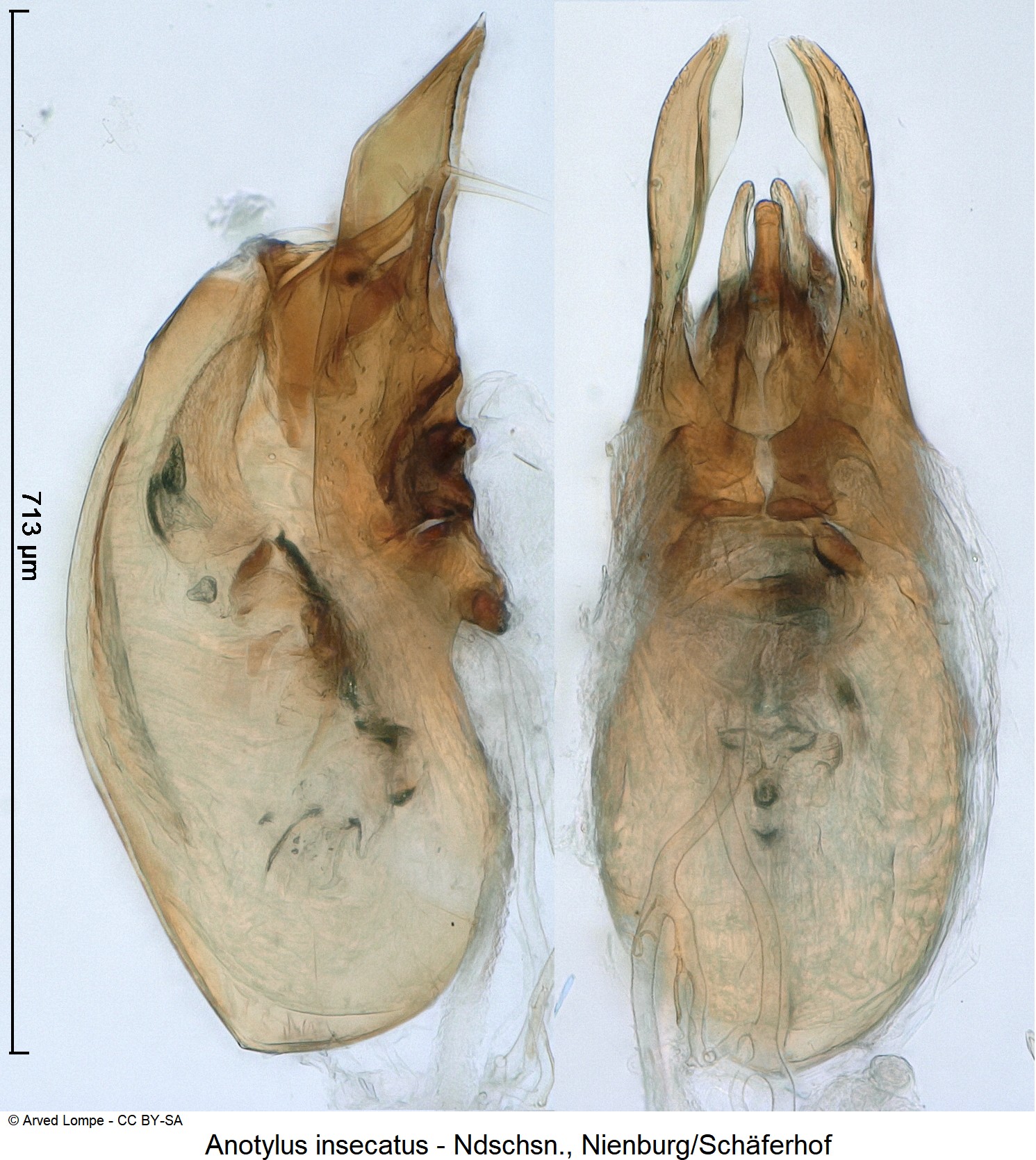anotylus_insecatus_ck18299.jpg