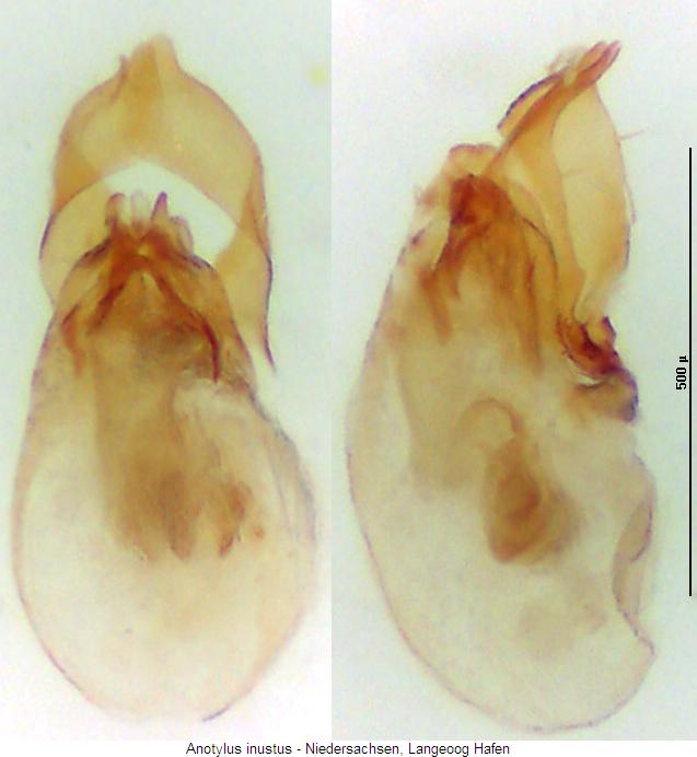 anotylus_inustus.jpg