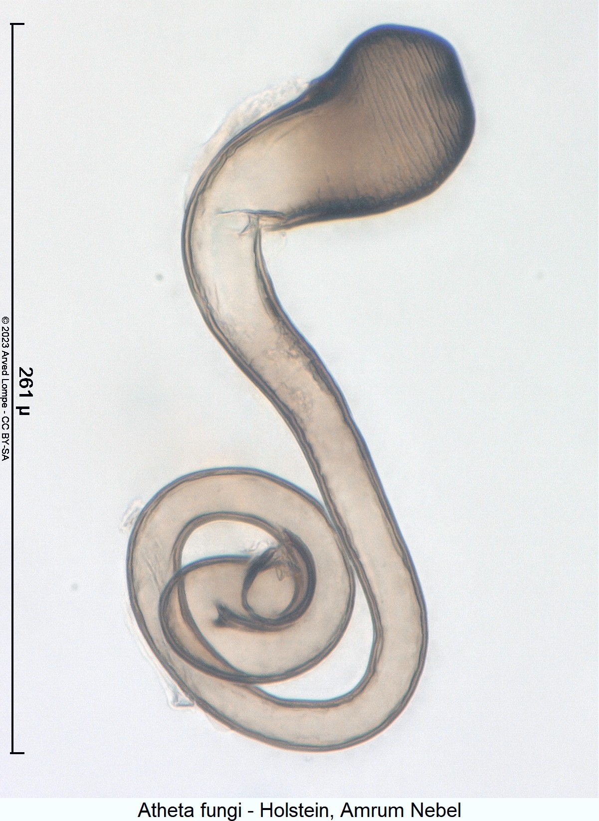 atheta_fungi_sperm2.jpg
