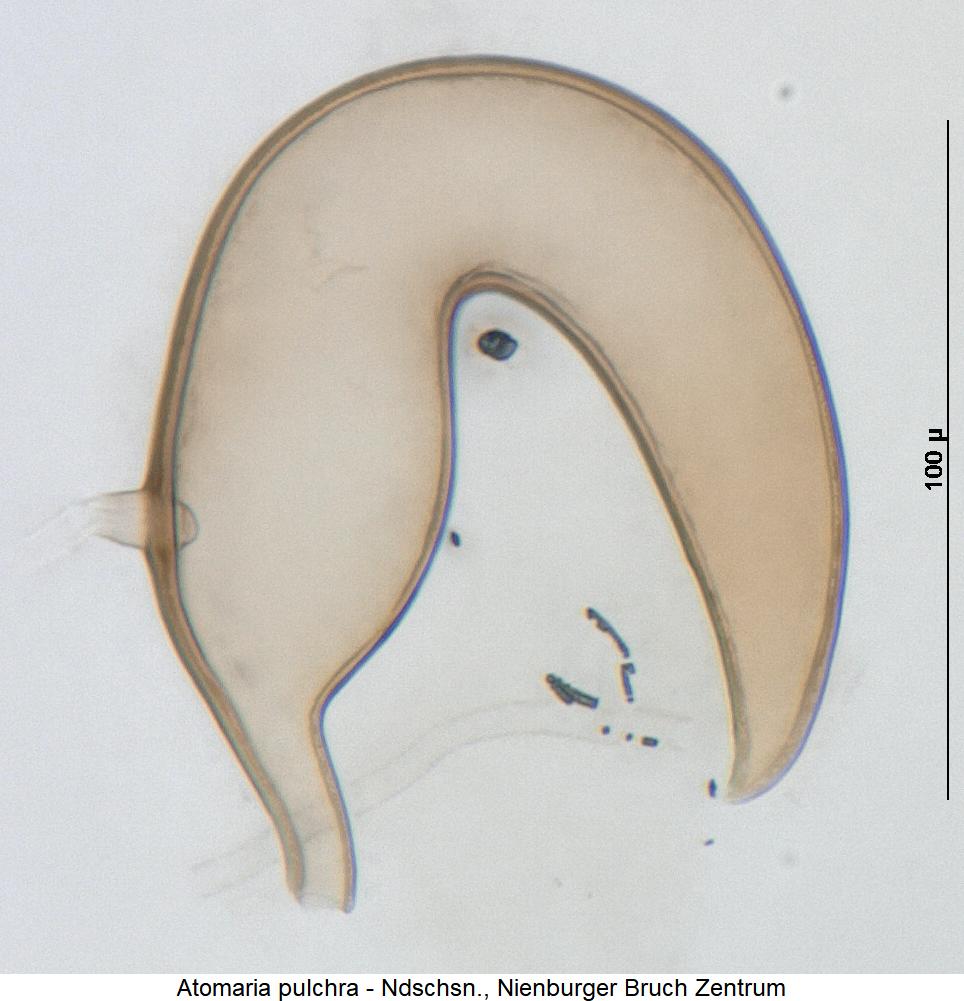 atomaria_pulchra_sperm.jpg