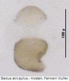 bledius_atricapillus_sperm.jpg