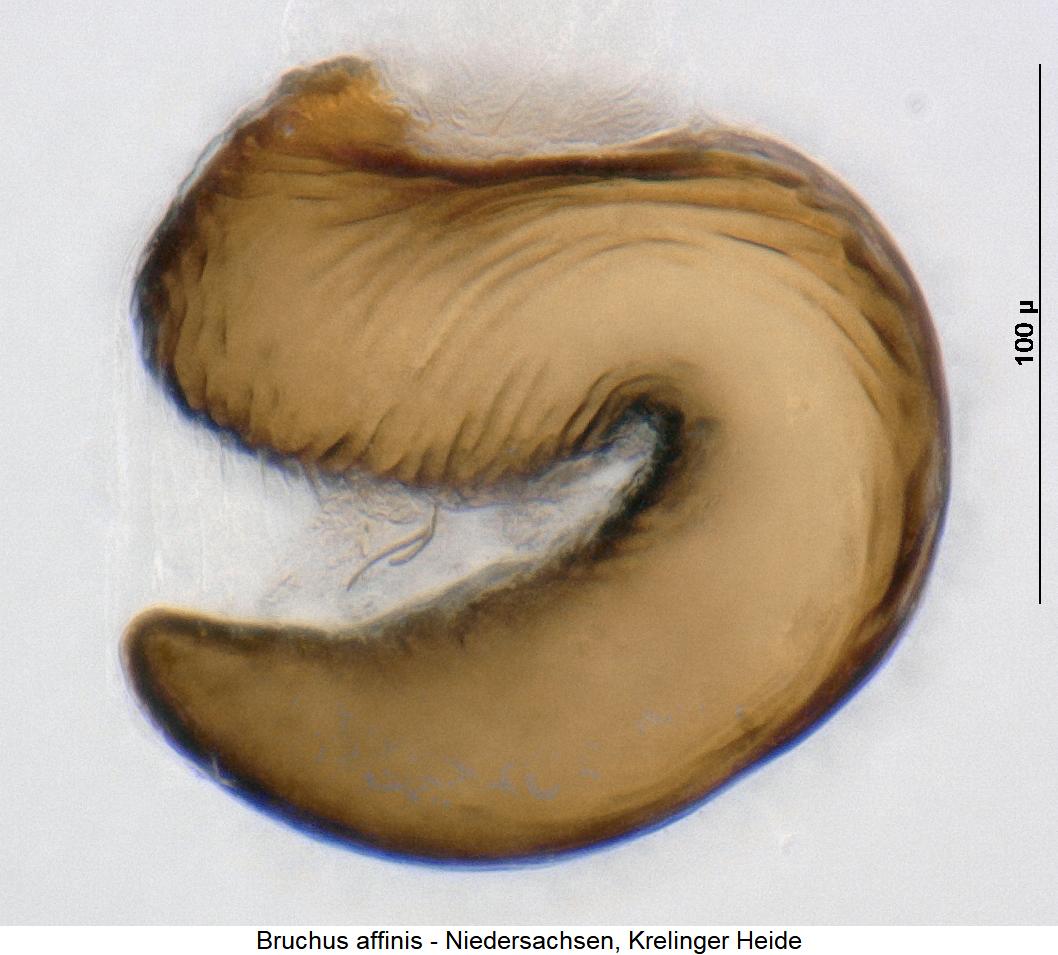 bruchus_affinis_sperm.jpg