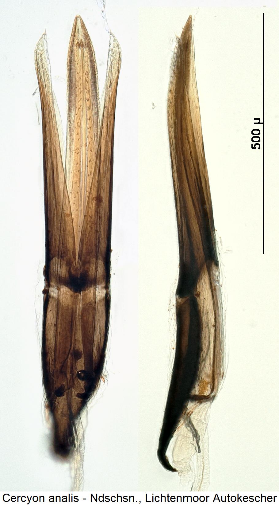cercyon_analis1.jpg