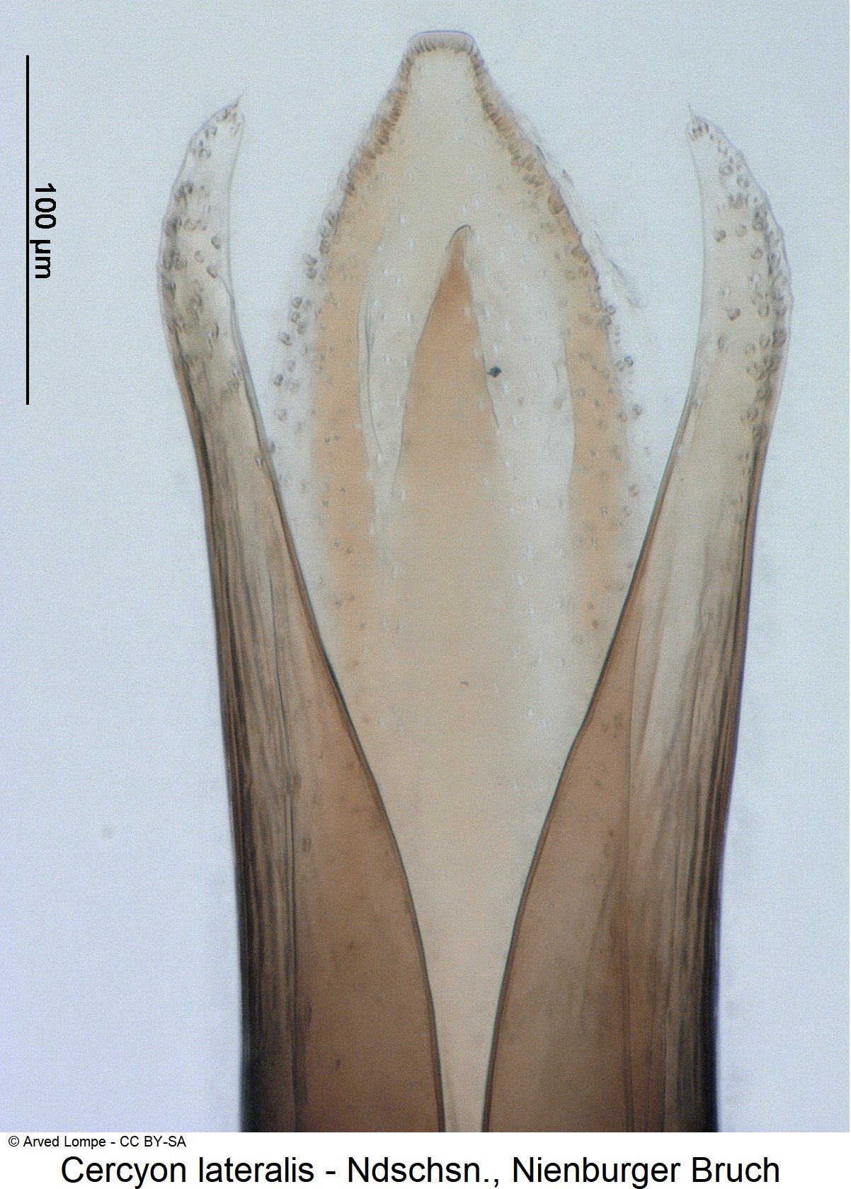cercyon_lateralis_ck35950343_pen.jpg