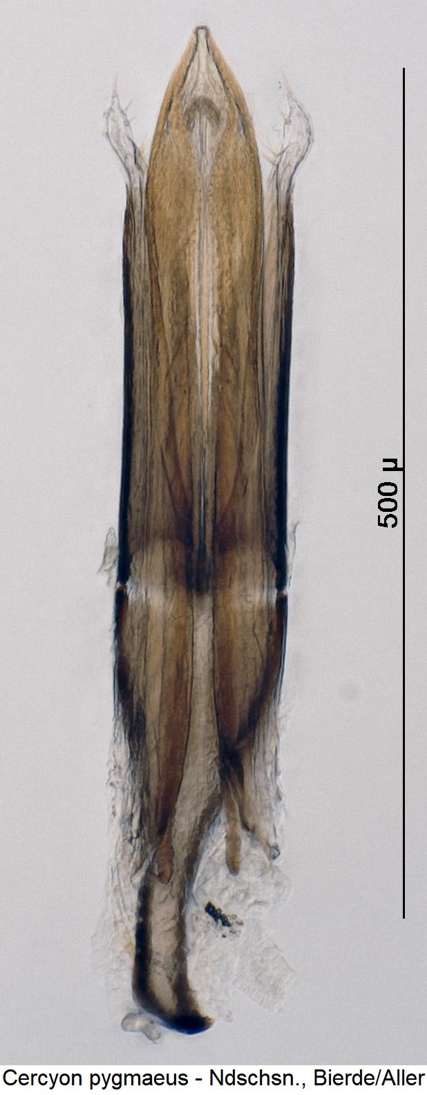 cercyon_pygmaeus1.jpg