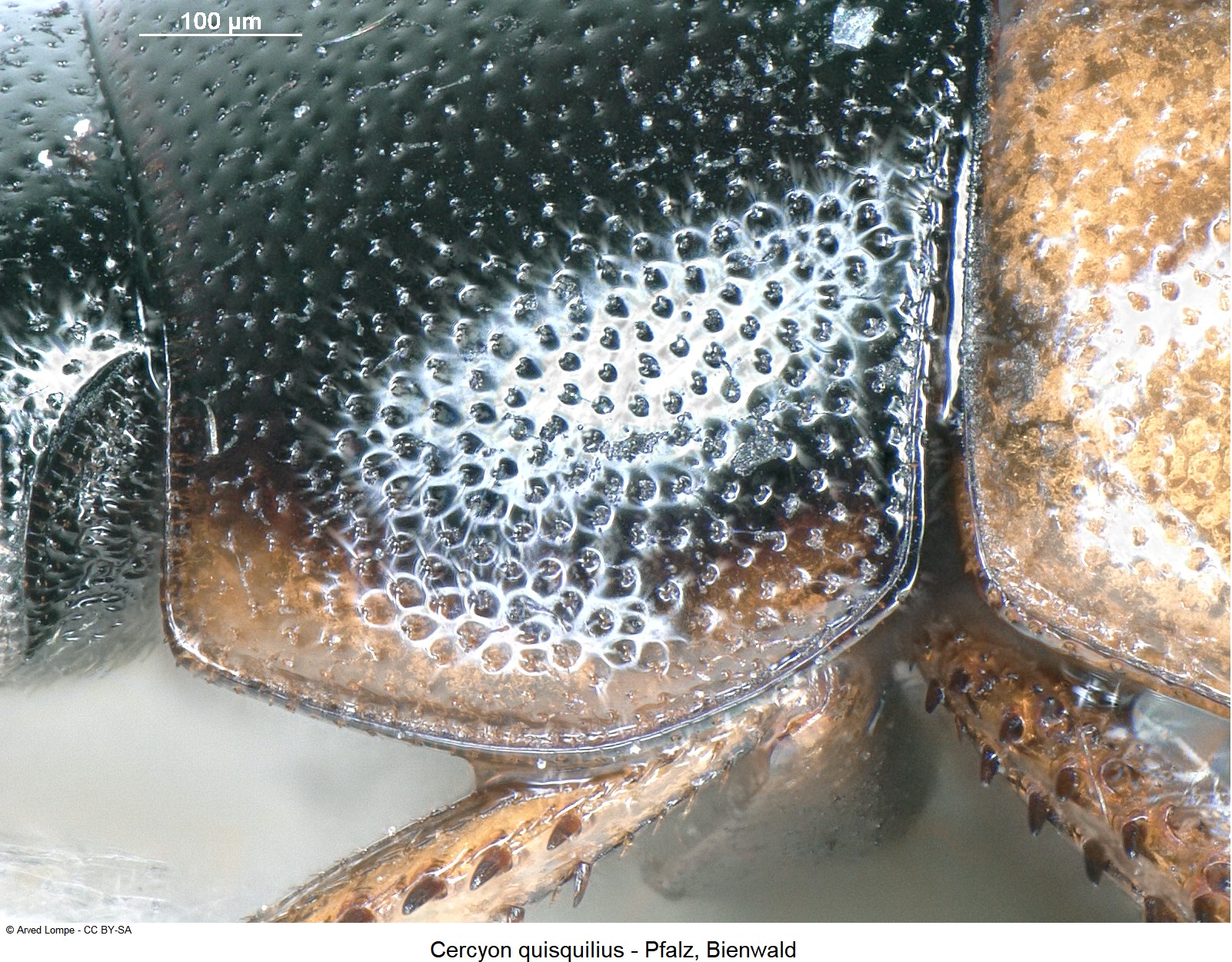 cercyon_quisquilius_ck23884_hum.jpg