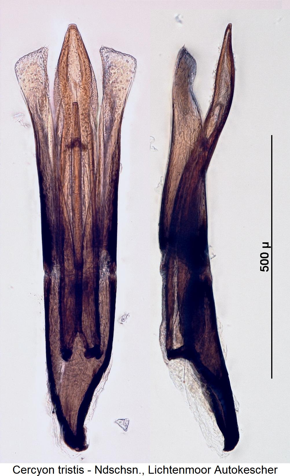 cercyon_tristis.jpg