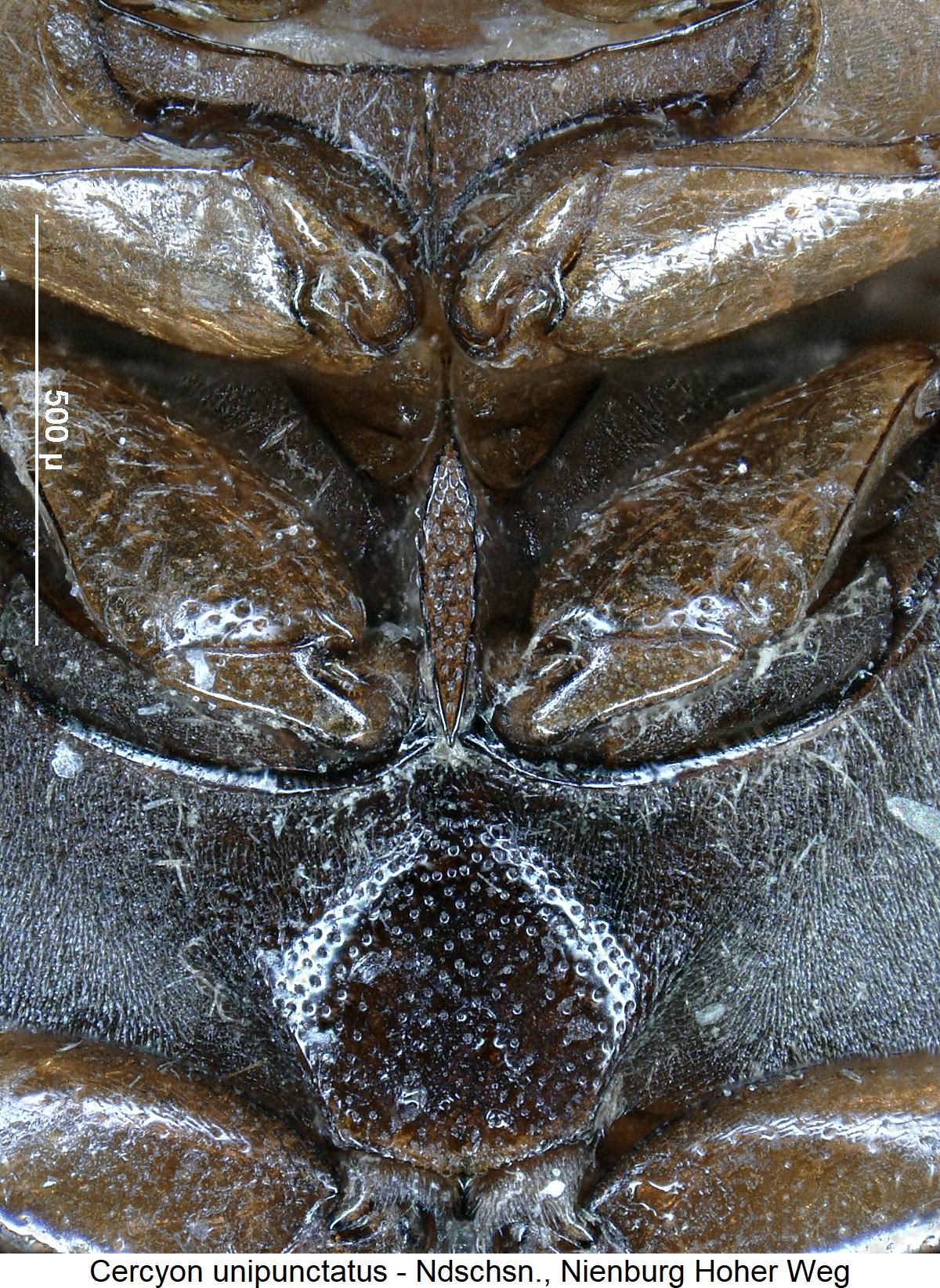 cercyon_unipunctatus_us.jpg
