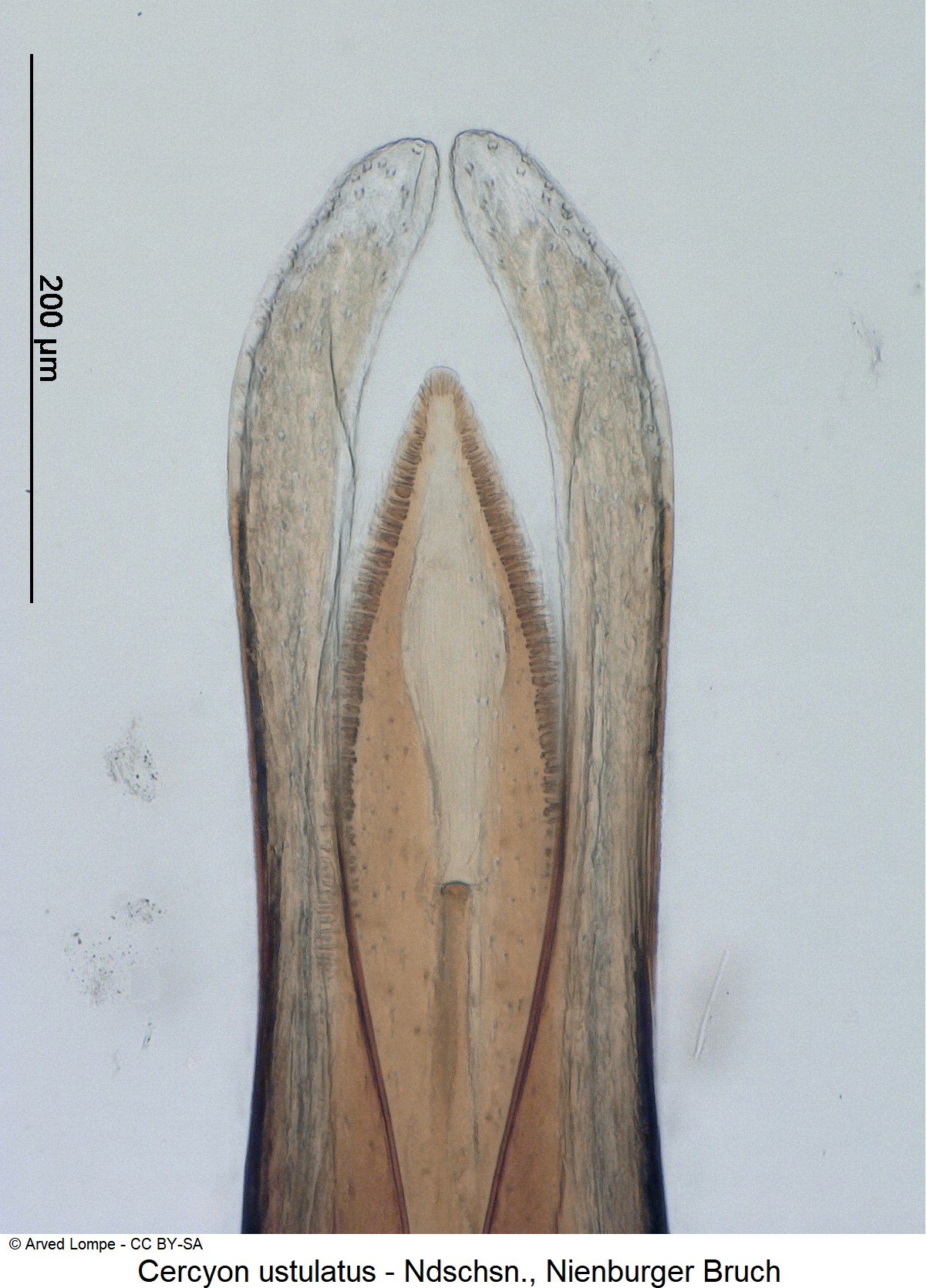 cercyon_ustulatus_ck35557655_detail-1.jpg