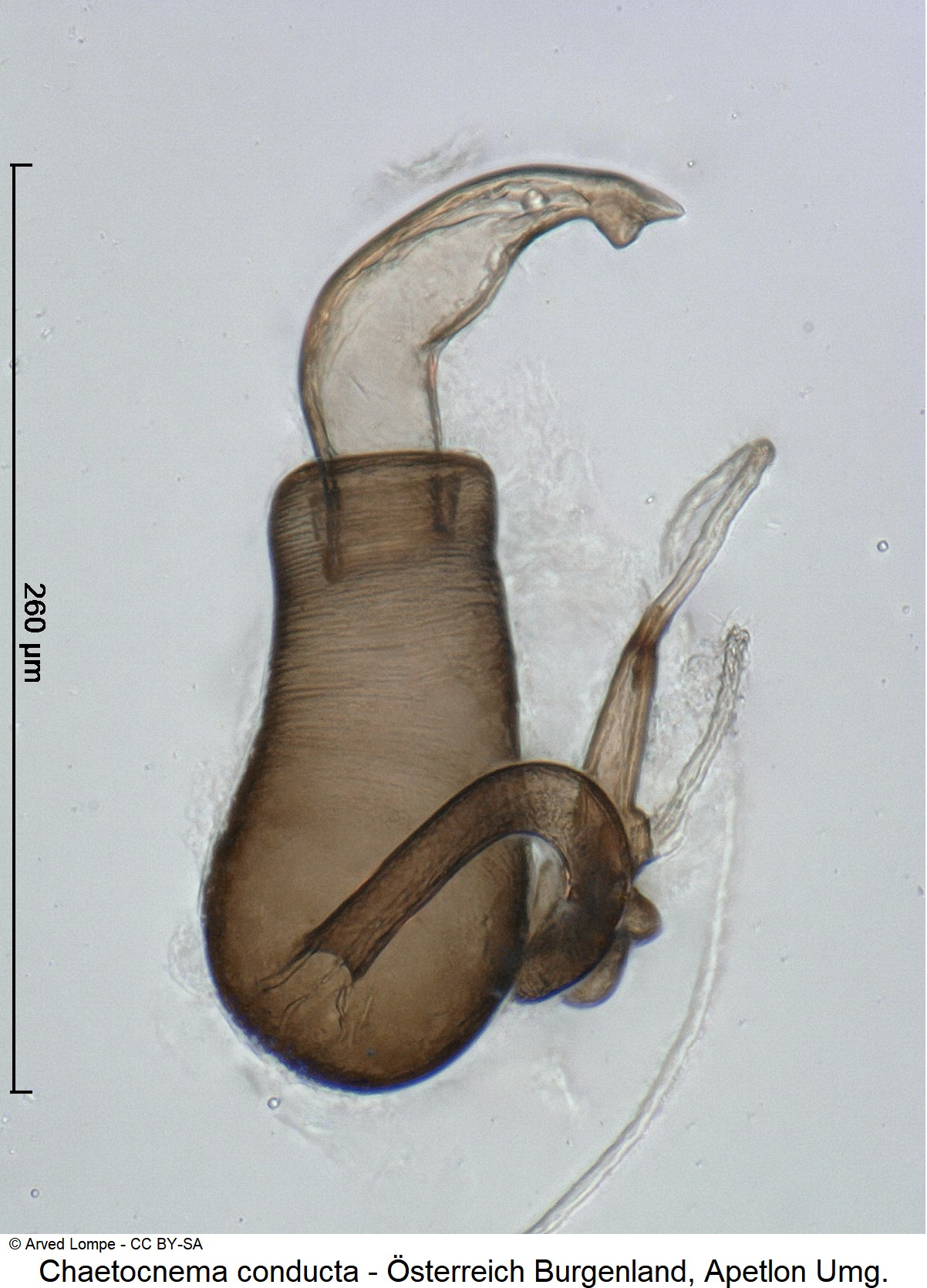 chaetocnema_conducta_ck35237442_sperm.jpg