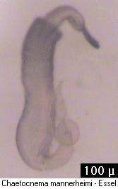 chaetocnema_mannerheimi_sperm.jpg