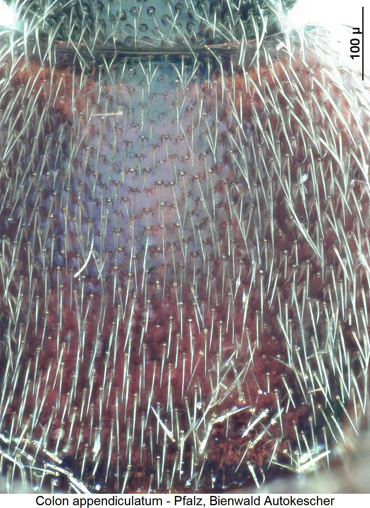 colon_appendiculatum_ms.jpg