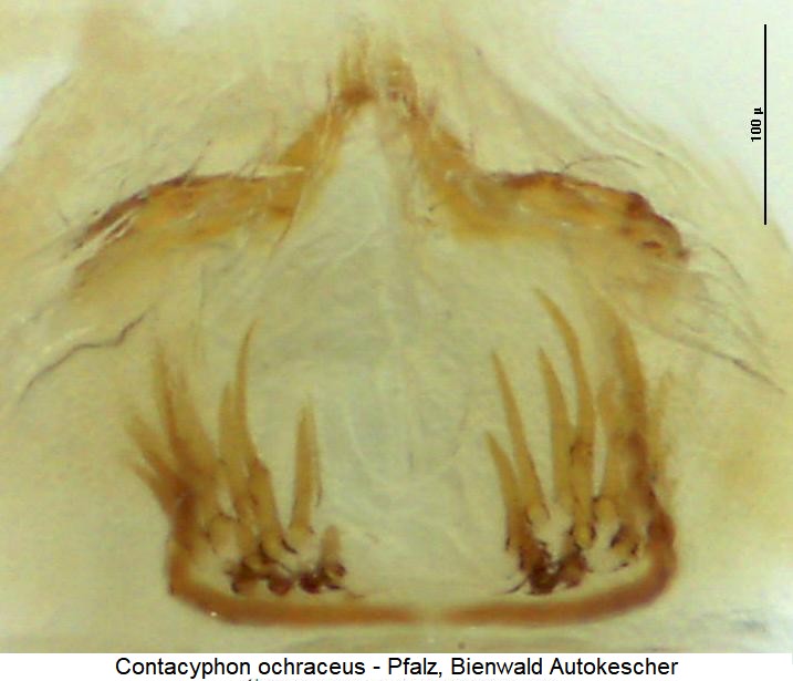 contacyphon_ochraceus_sperm.jpg