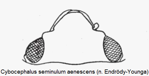 cybocephalus_aenescens_k.gif