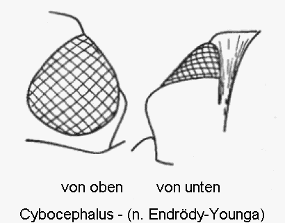 cybocephalus_augen.gif
