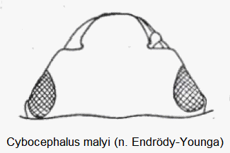 cybocephalus_malyi_k.gif