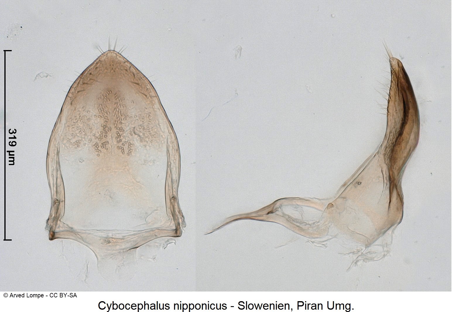 cybocephalus_nipponicus_pm.jpg