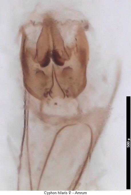 cyphon_hilaris_sperm.jpg