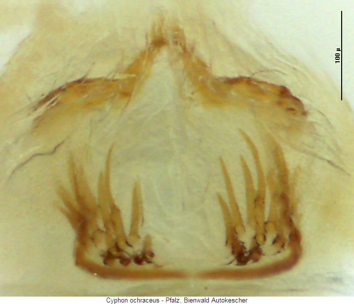 cyphon_ochraceus_sperm.jpg