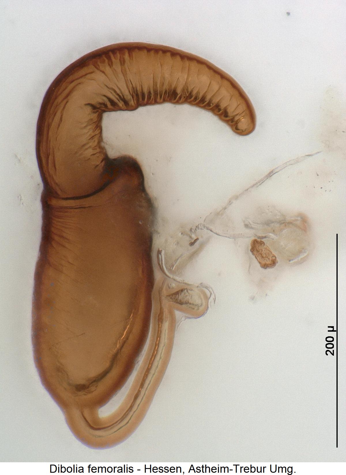 dibolia_femoralis_sperm.jpg