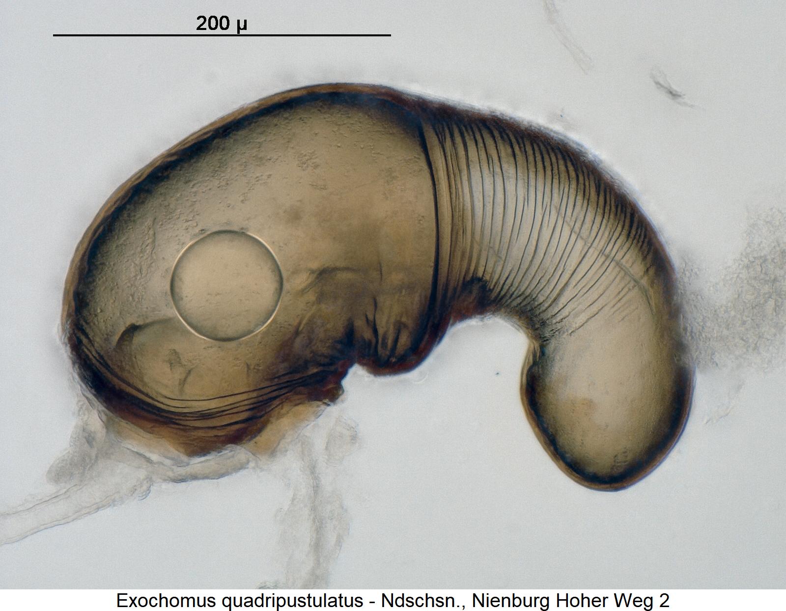 exochomus_quadripustulatus_sperm.jpg