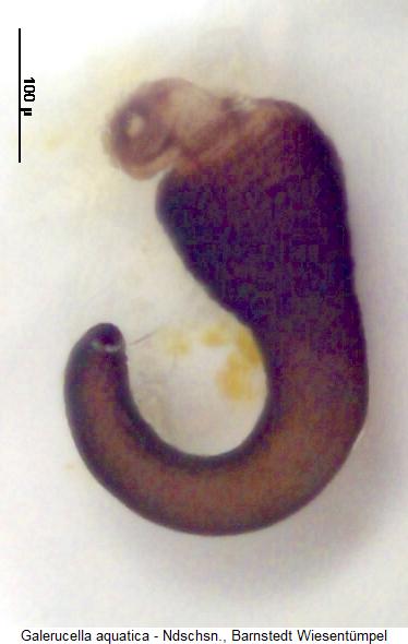 galerucella_aquatica_sperm.jpg
