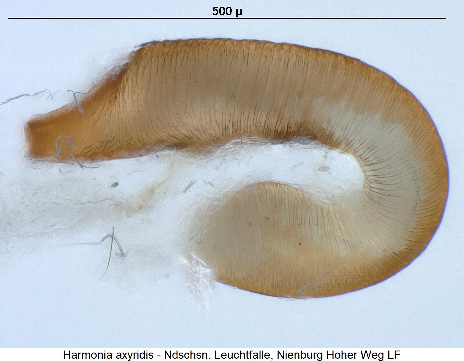 harmonia_axyridis_sperm.jpg