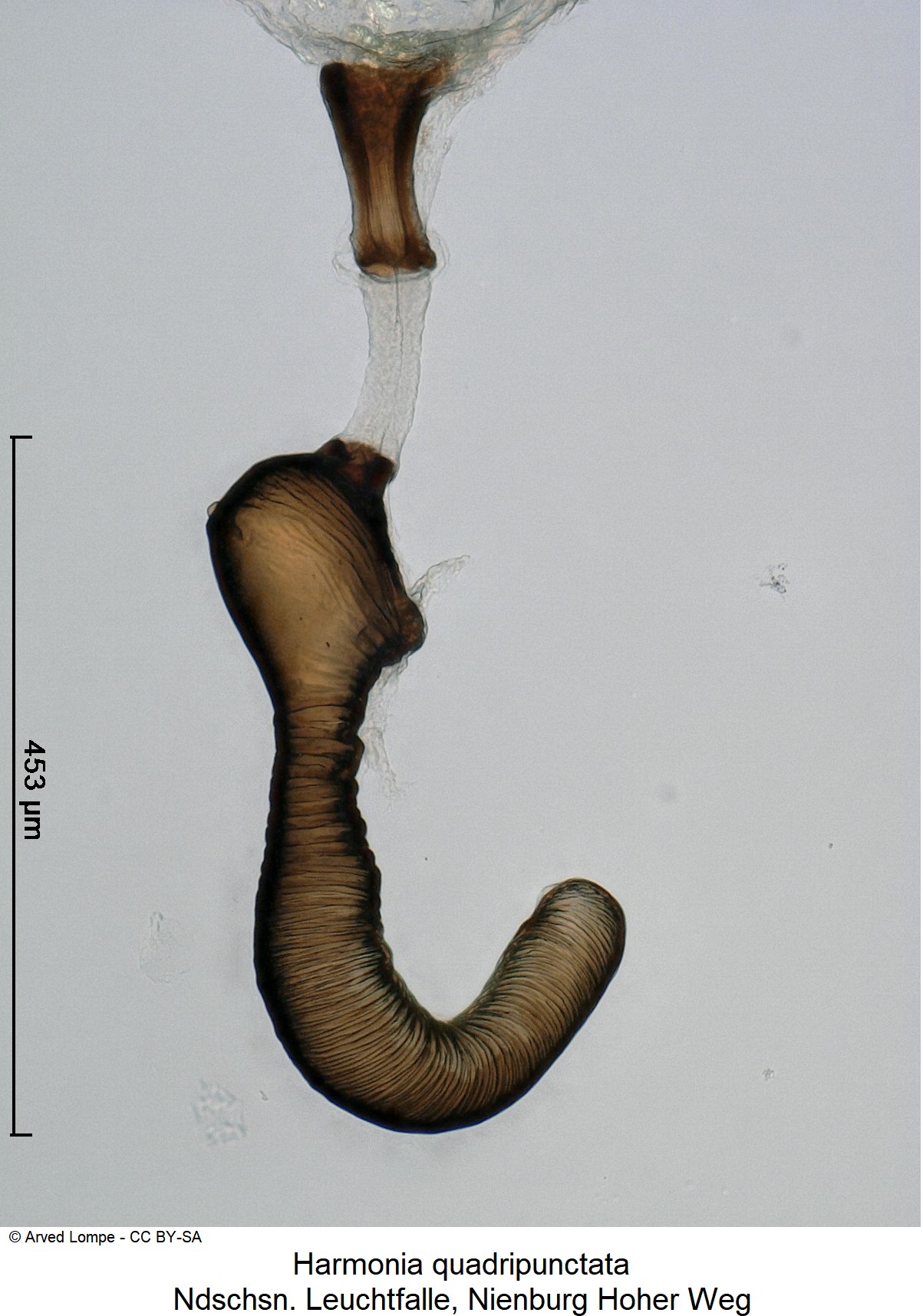 harmonia_quadripunctata_ck33408705_sperm.jpg