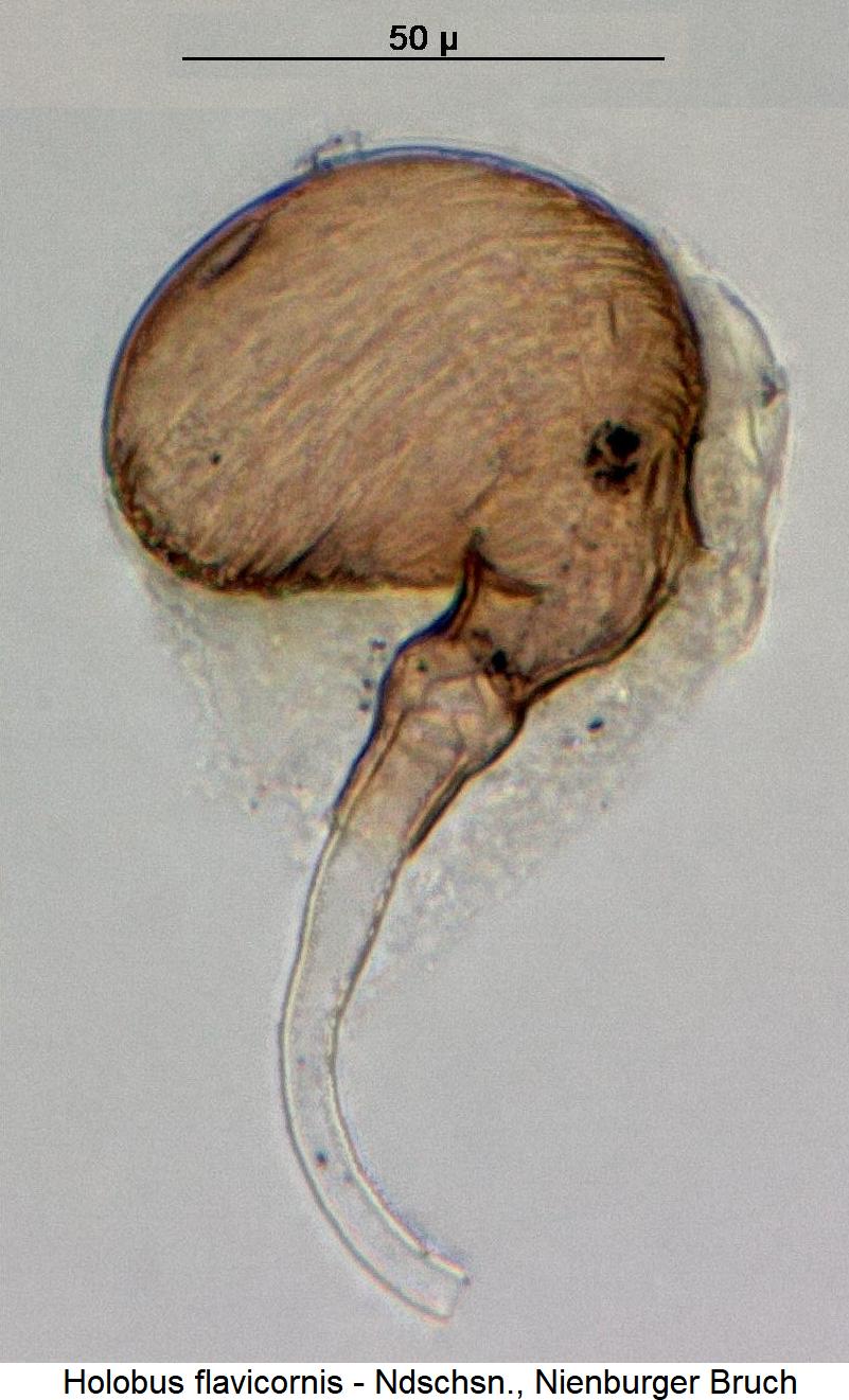 holobus_flavicornis_sperm1.jpg