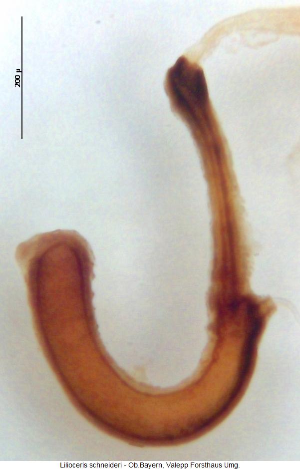 lilioceris_schneideri_sperm.jpg