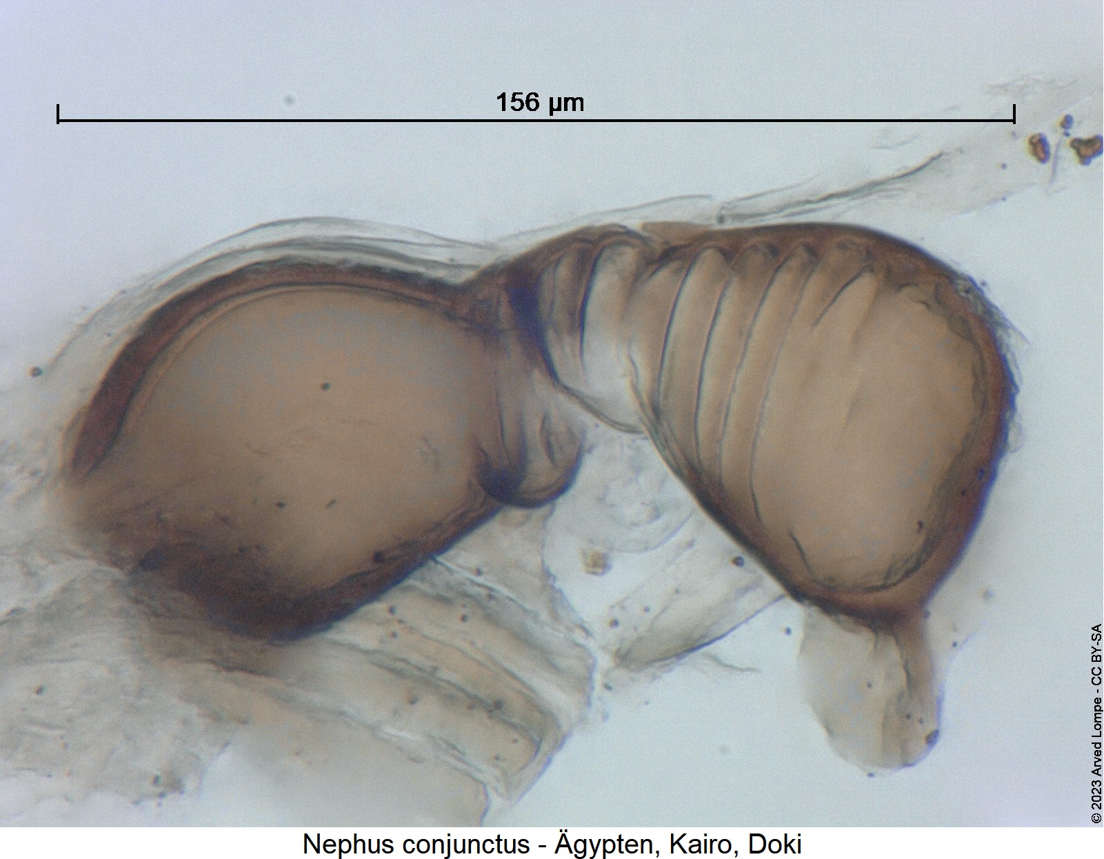 nephus_conjunctus_ck28441180_sperm.jpg