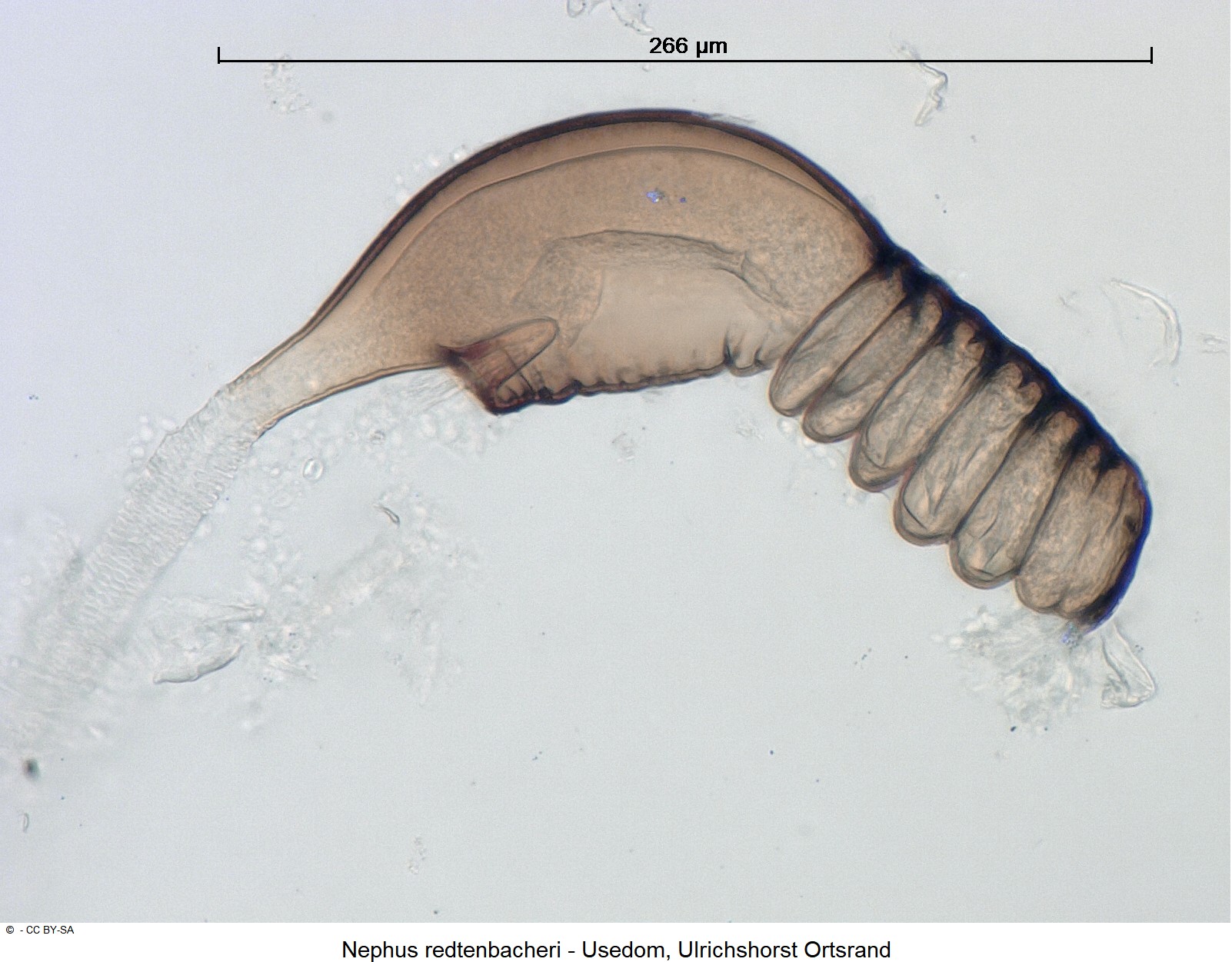 nephus_redtenbacheri_ck23066_sperm.jpg