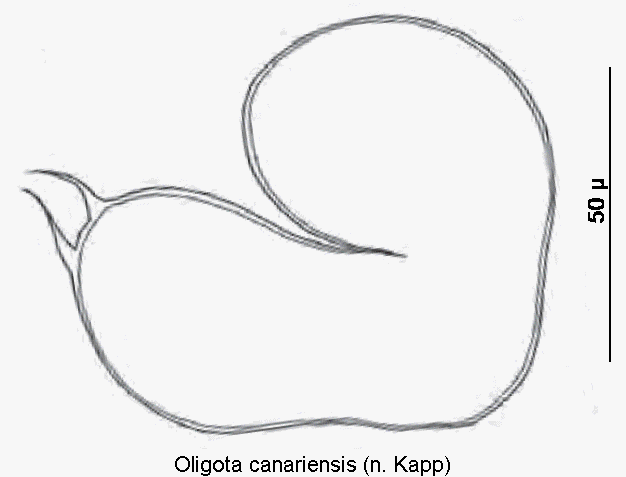 oligota_canariensis_sperm.gif