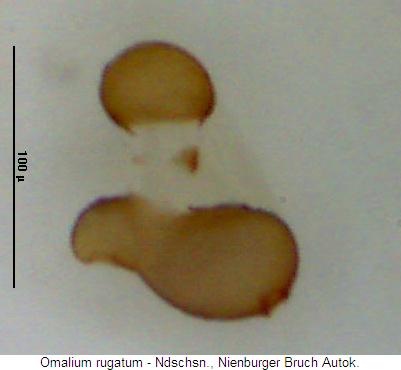 omalium_rugatum_sperm.jpg