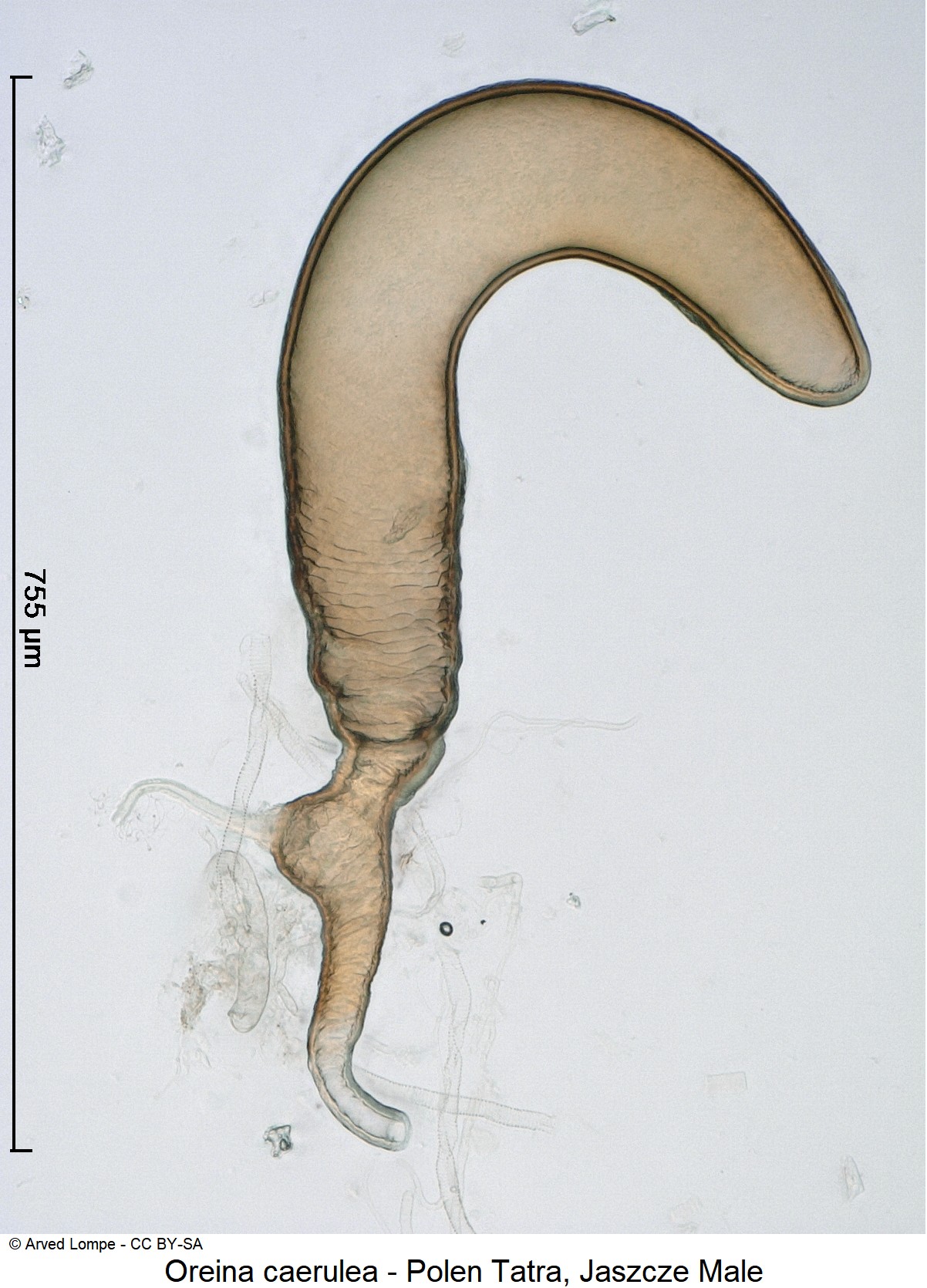 oreina_caerulea_ck33164536_sperm.jpg