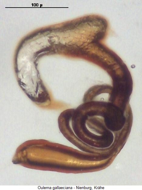 oulema_gallaeciana_sperm.jpg