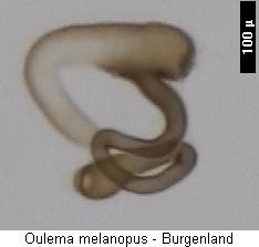 oulema_melanopus_sperm.jpg