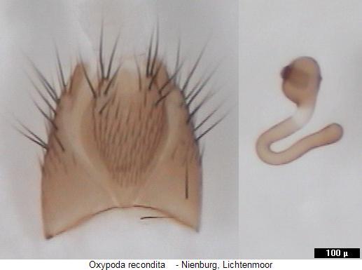 oxypoda_recondita_sperm.jpg