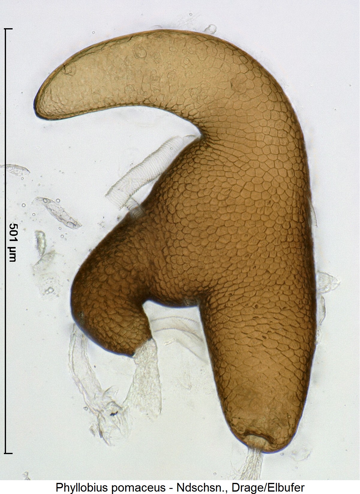phyllobius_pomaceus_ck13793_sperm.jpg