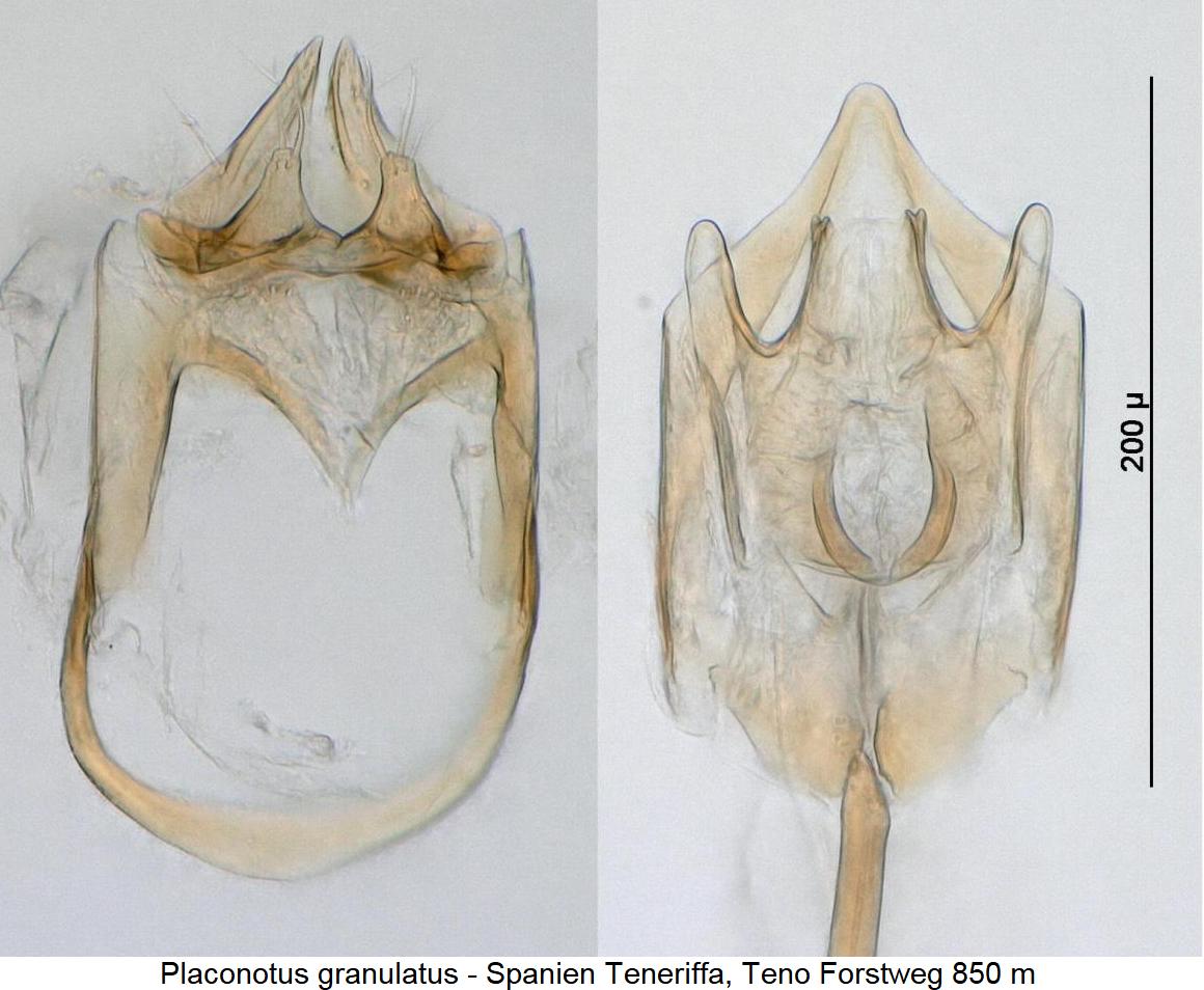 placonotus_granulatus_detail.jpg