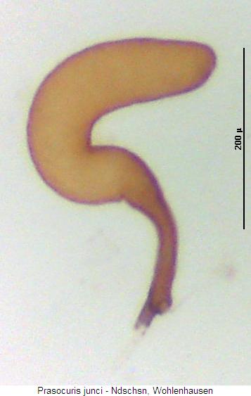 prasocuris_junci_sperm.jpg