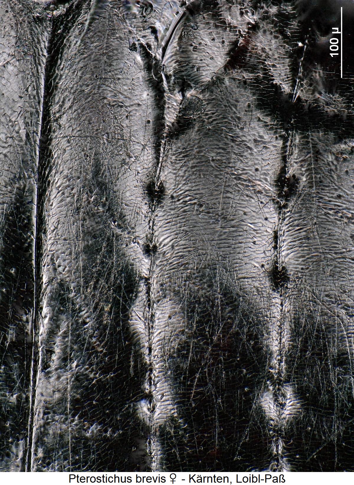 pterostichus_brevis_w_ms.jpg